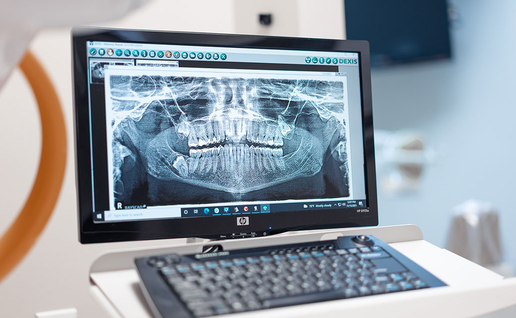 wisdom teeth x-ray