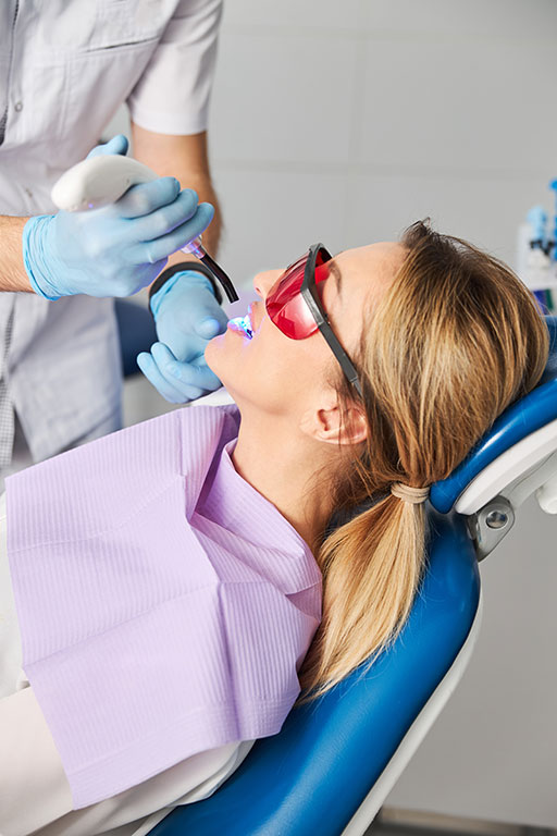 composite fillings