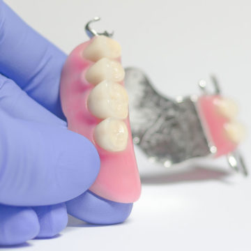 partial denture