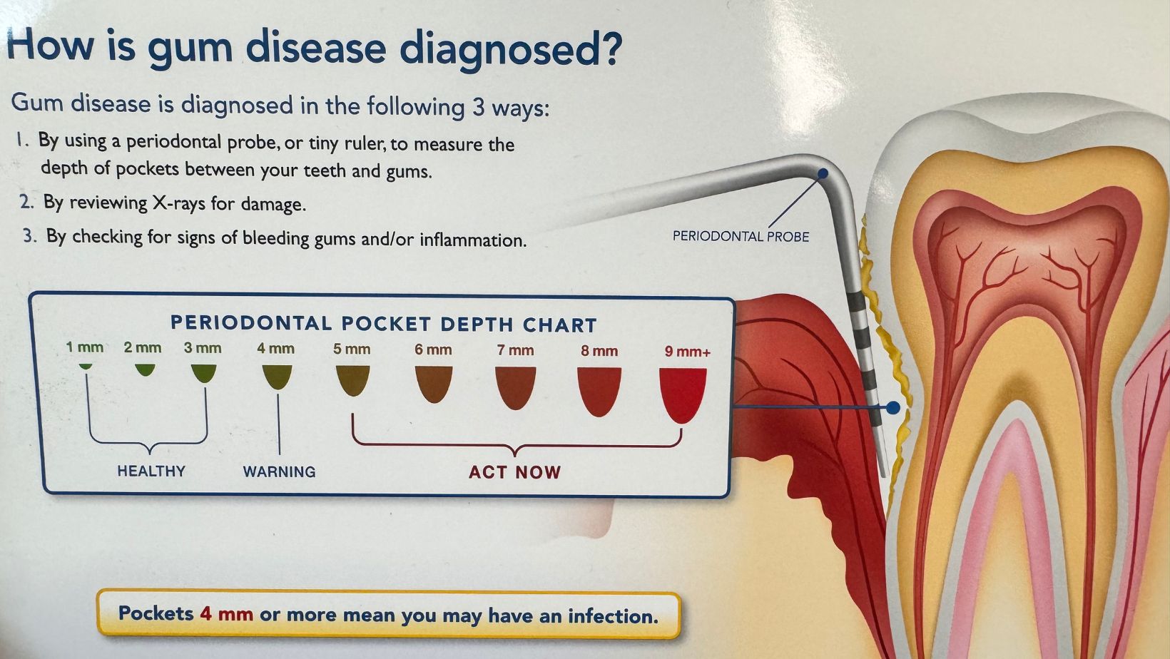 gum disease info