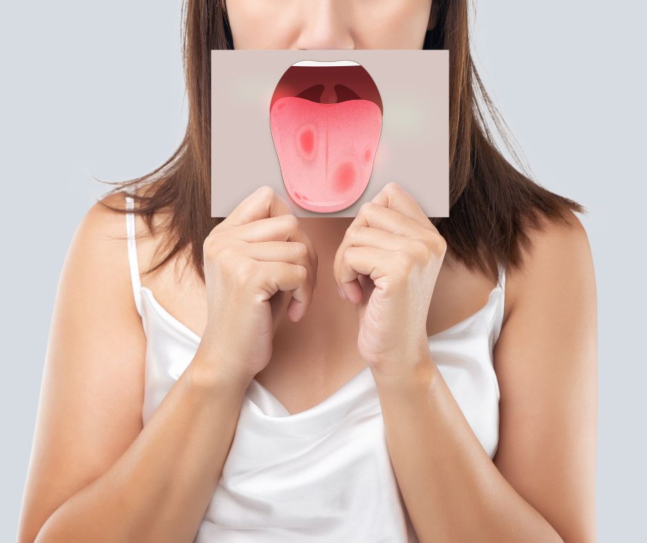 oral cancer tongue